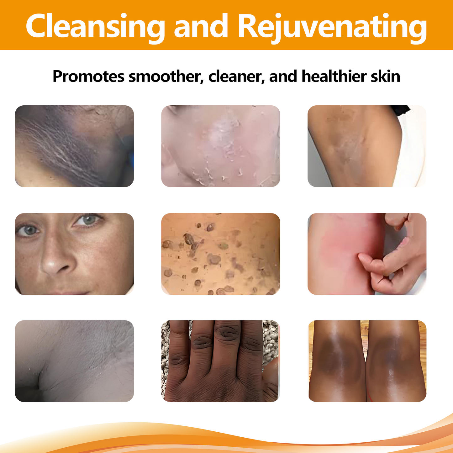 Skavix™Orange Enzyme Exfoliating Gel — The Gentle Miracle Your Skin Has Been Crying Out For
